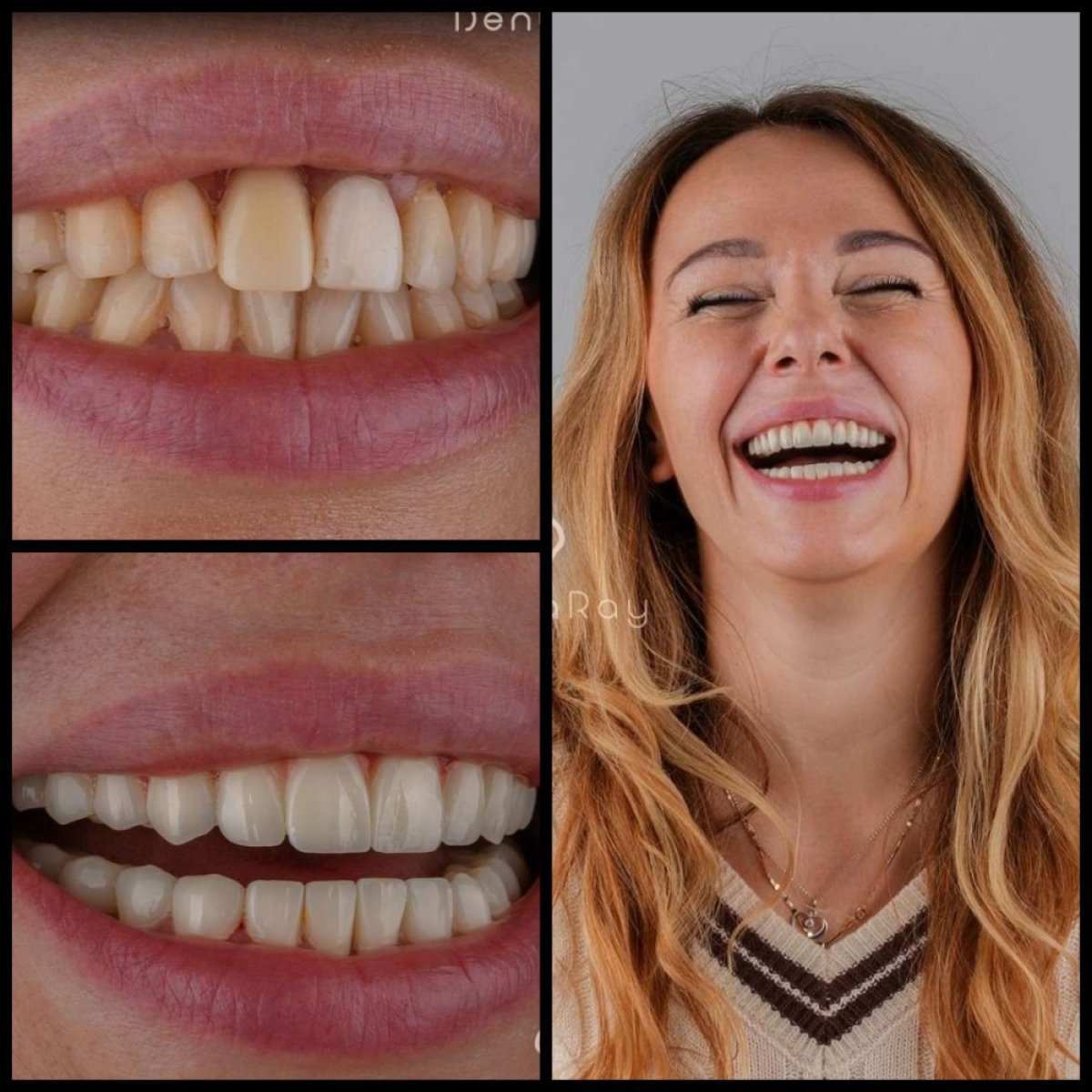 before and after photo