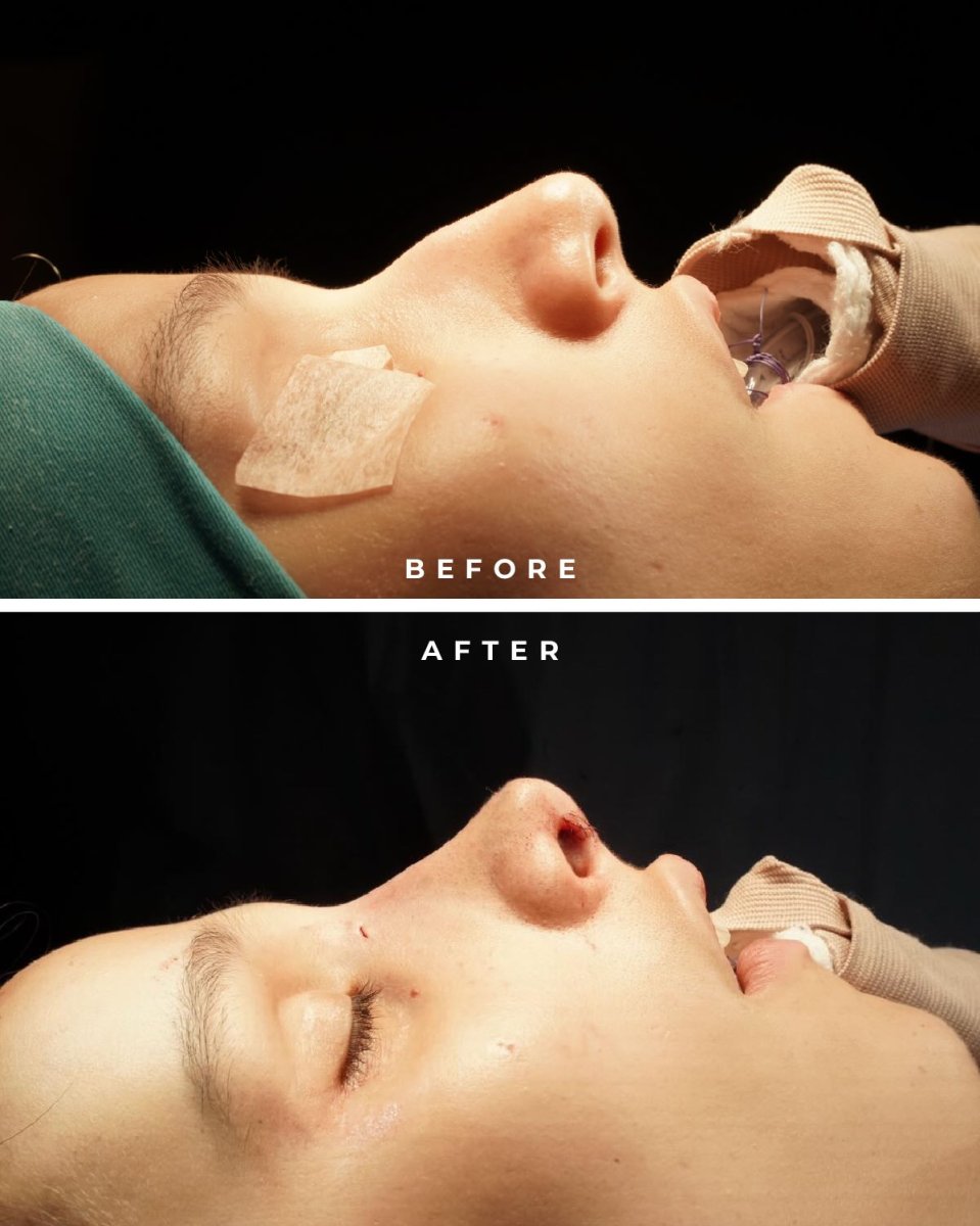 before and after photo