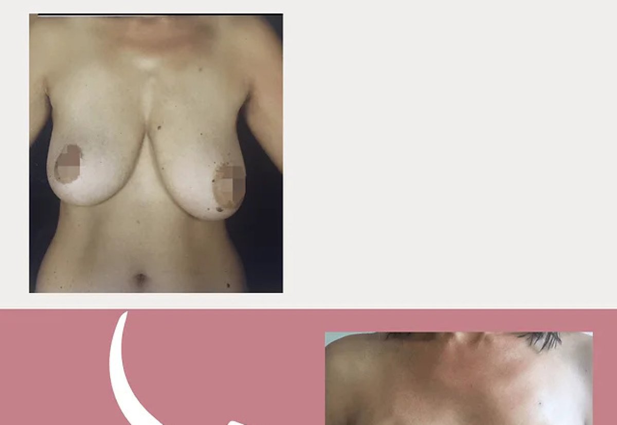 before and after photo