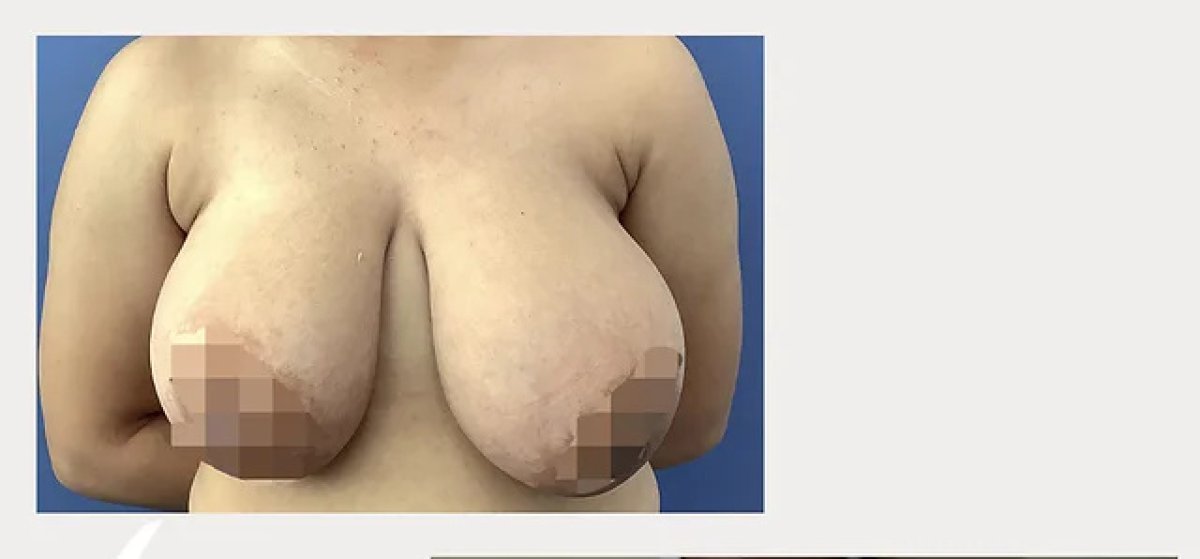 before and after photo
