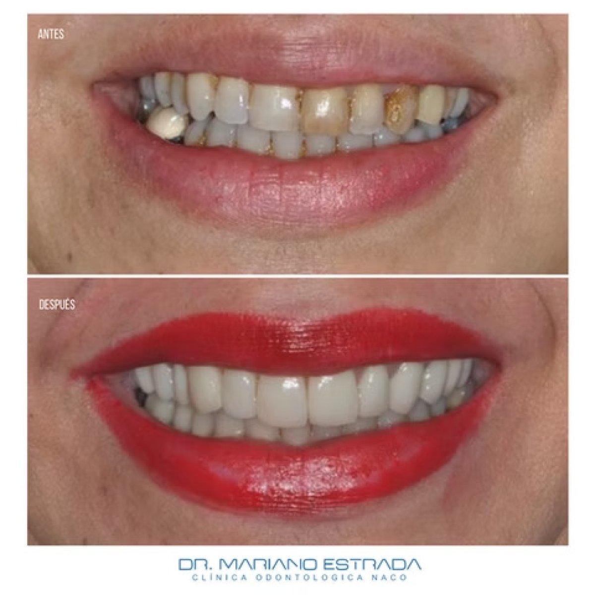 before and after photo