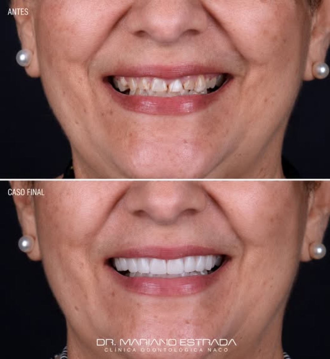 before and after photo