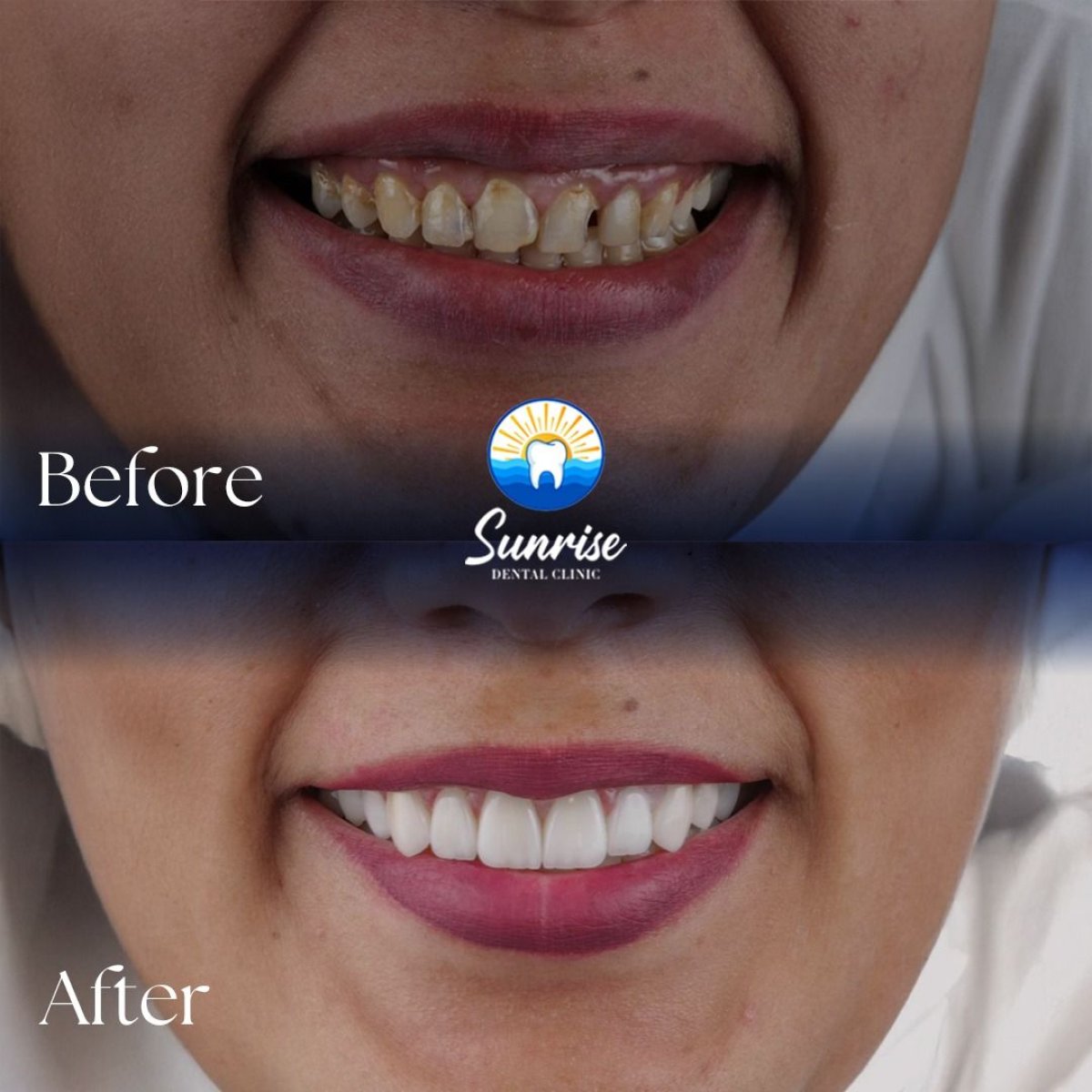 before and after photo