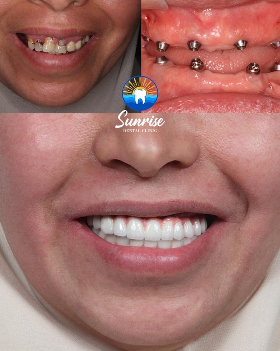 before and after photo