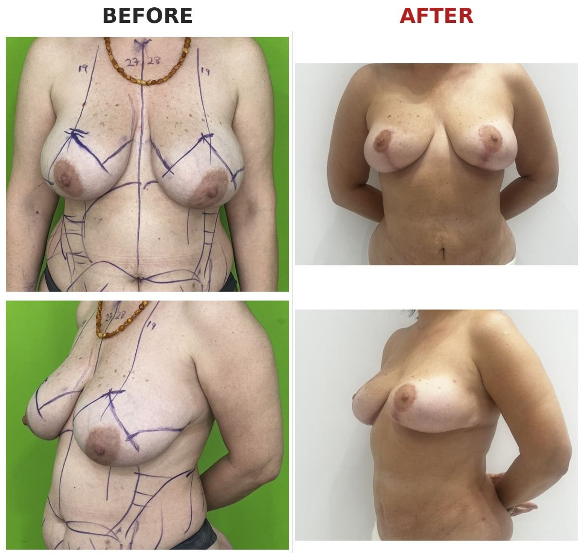 before and after photo
