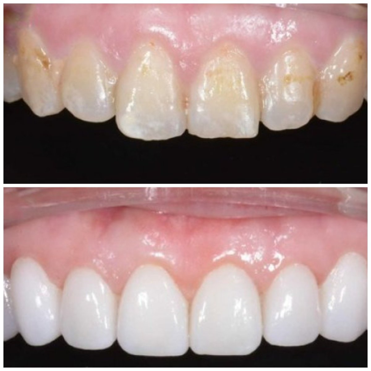 before and after photo