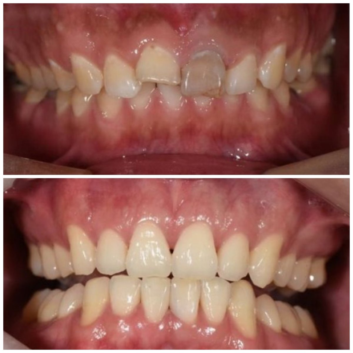 before and after photo