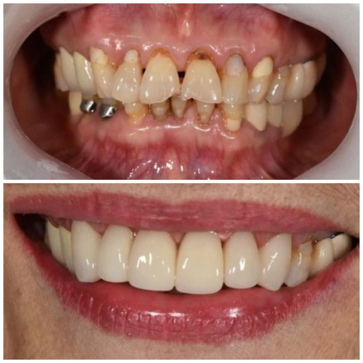 before and after photo