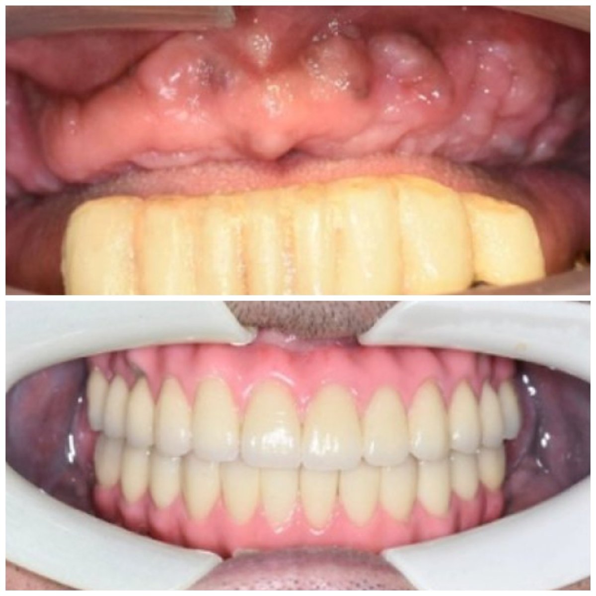 before and after photo