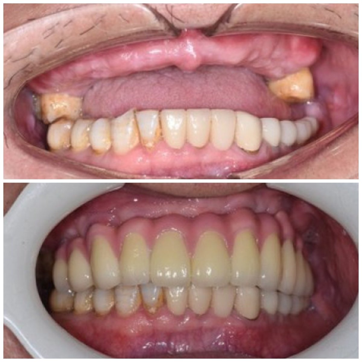 before and after photo