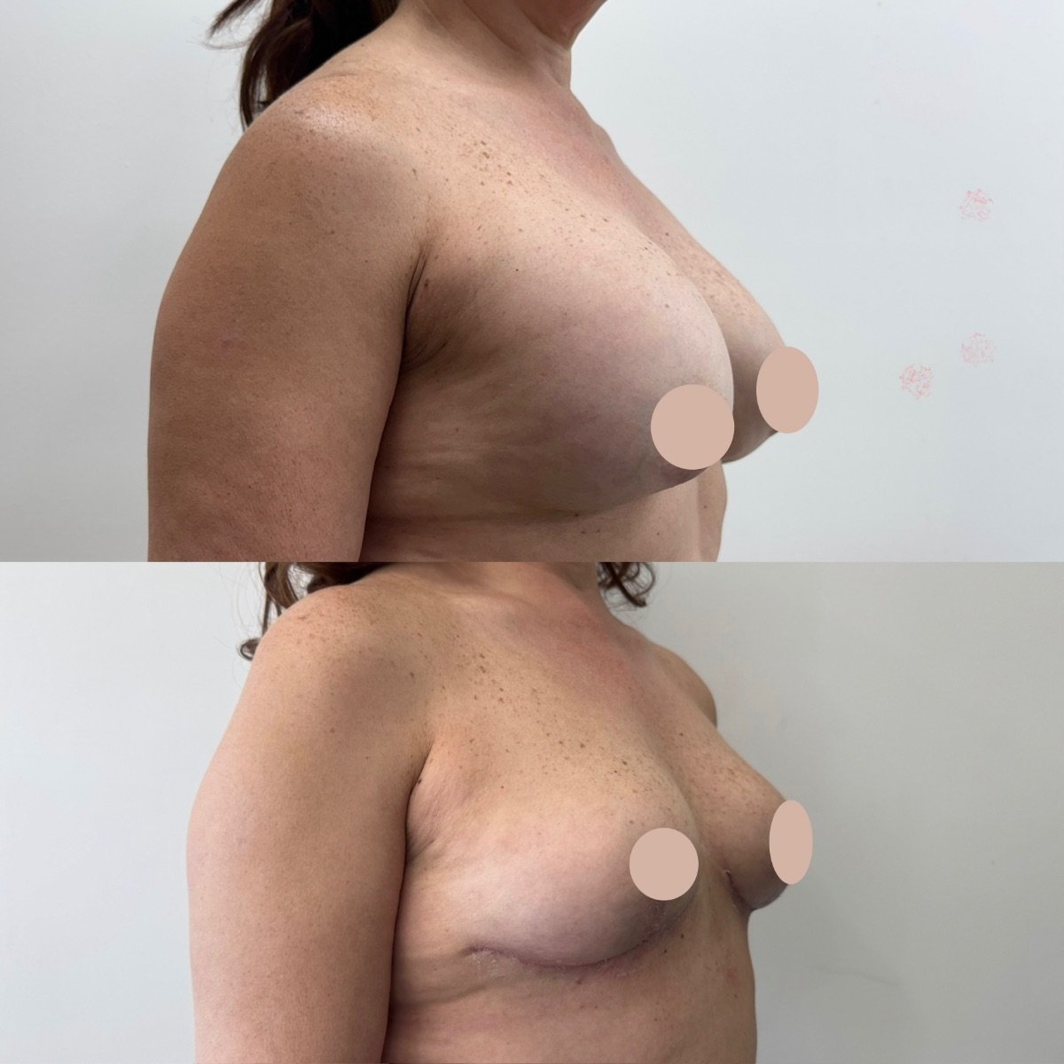 before and after photo