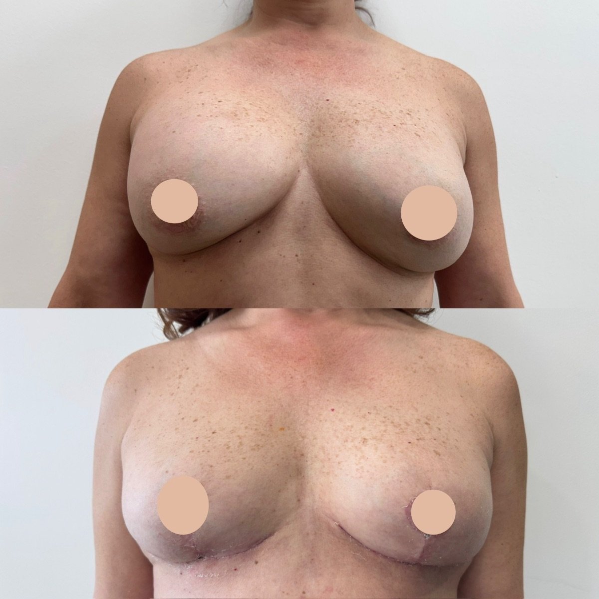 before and after photo