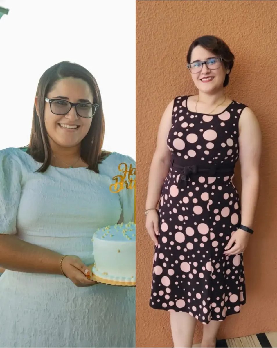 Before and after gastric sleeve surgery results – visible weight loss and body contour change