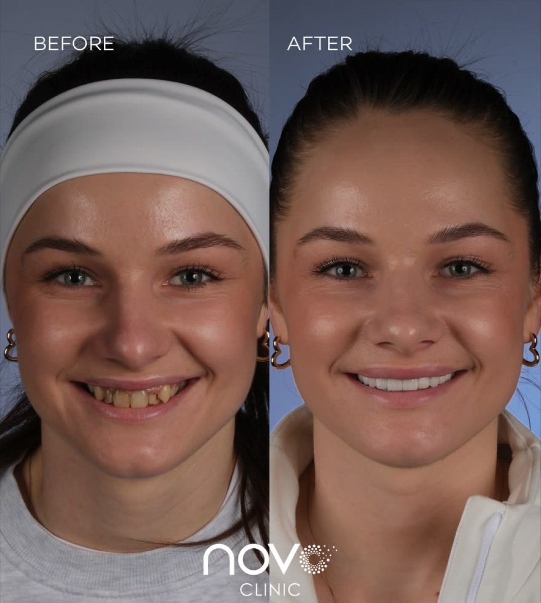 before and after photo