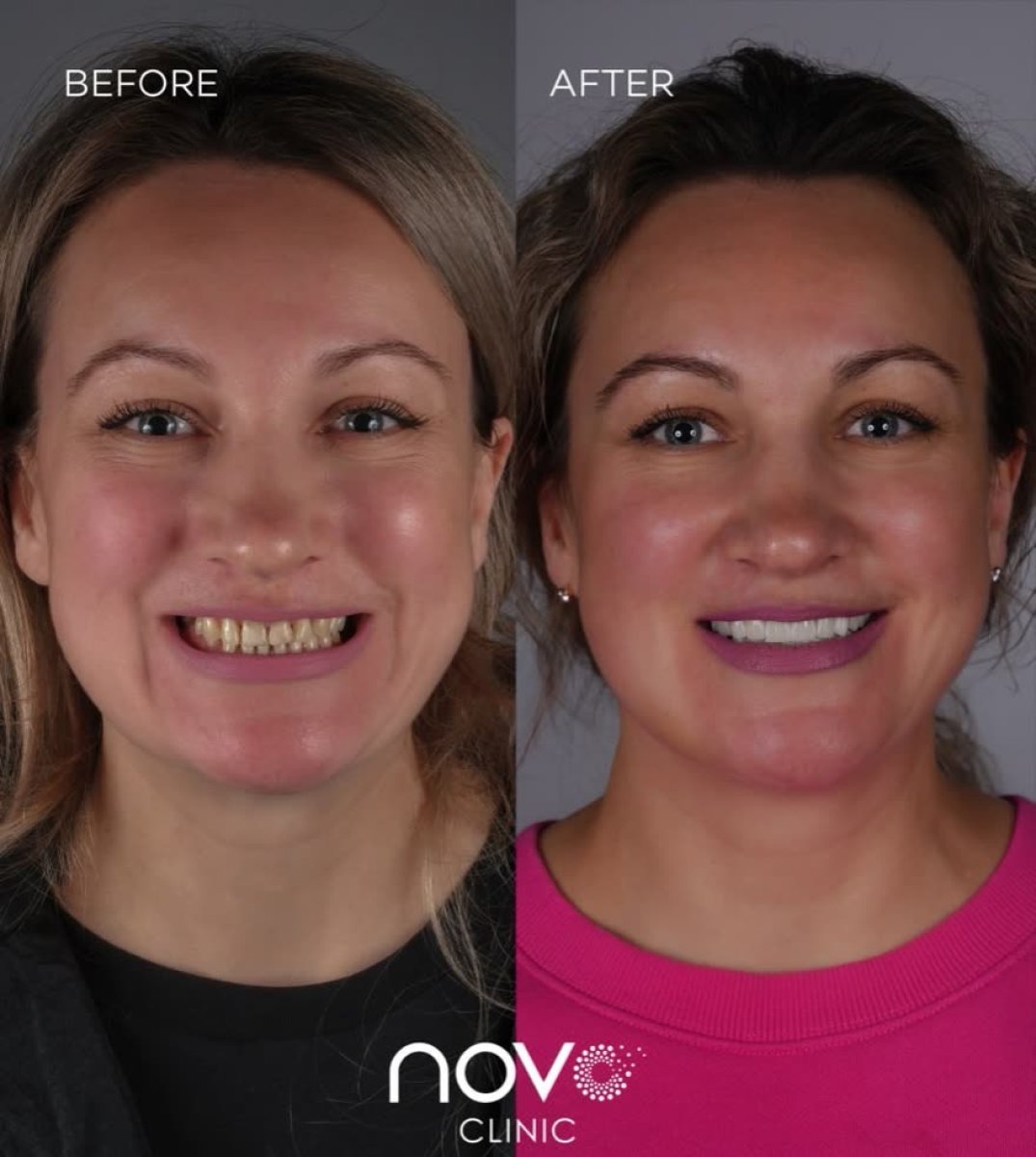 before and after photo