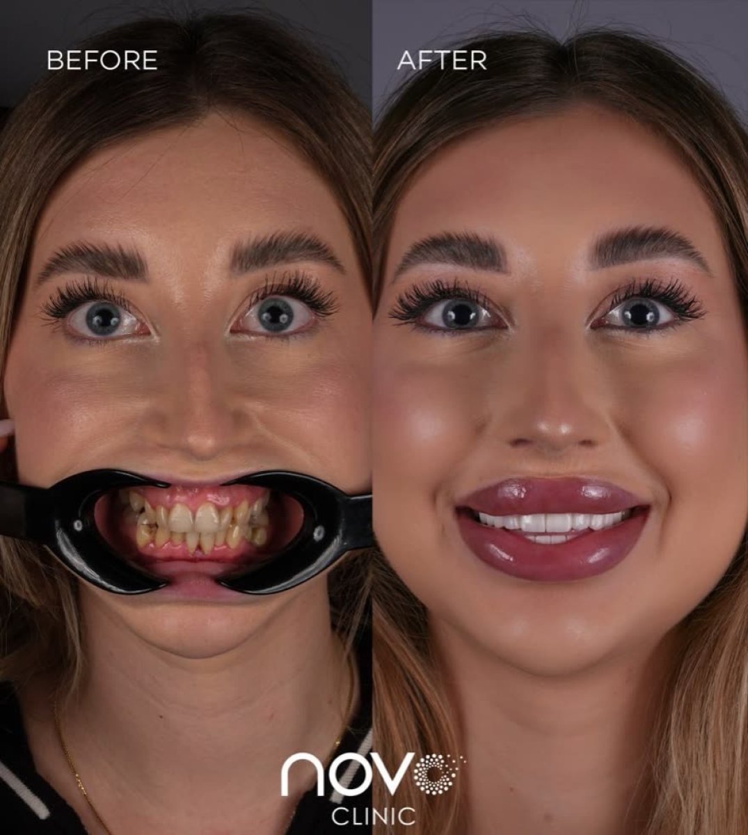 before and after photo