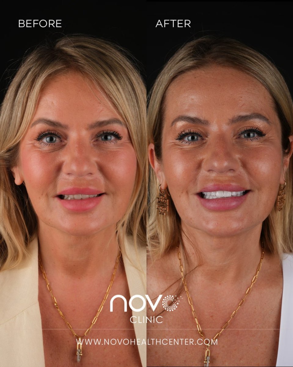 before and after photo