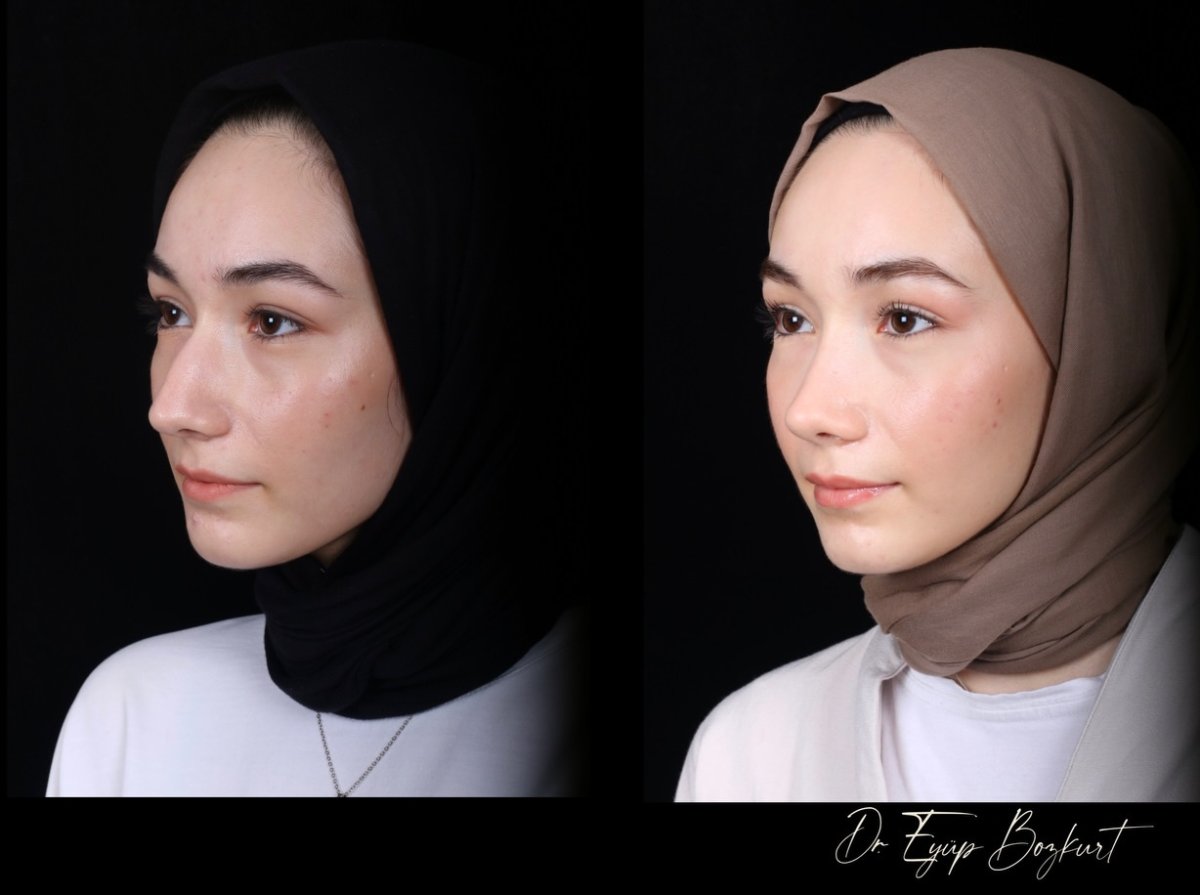 before and after photo