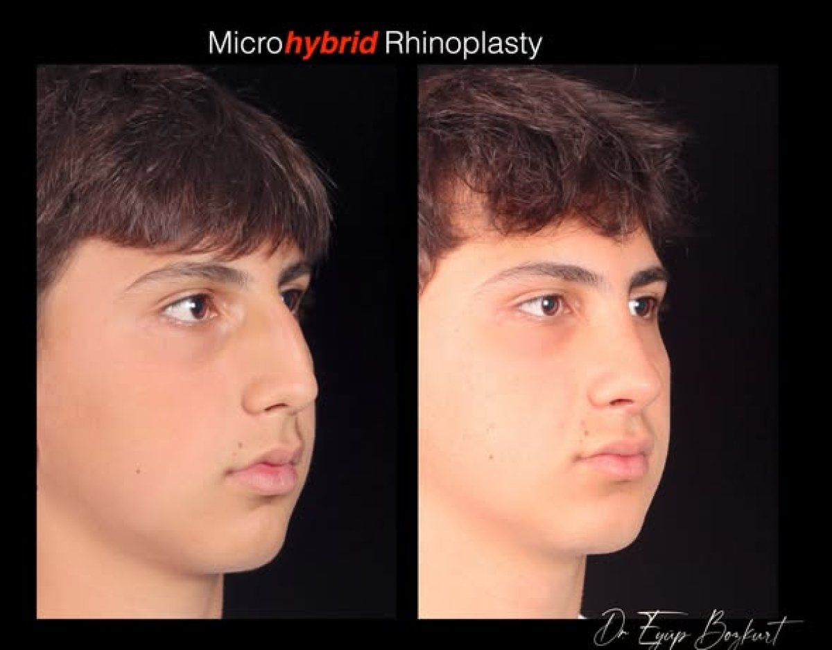before and after photo