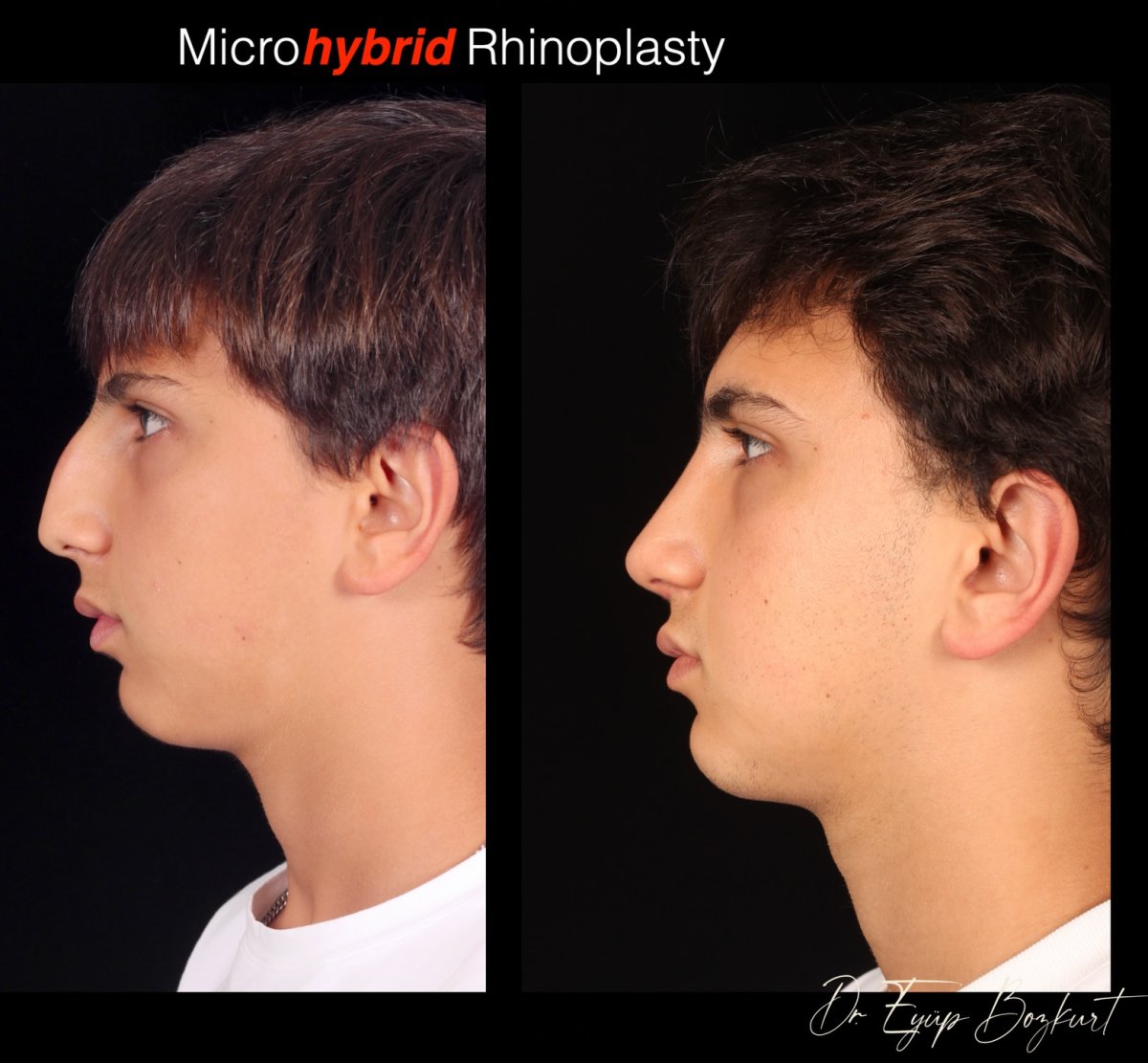 before and after photo