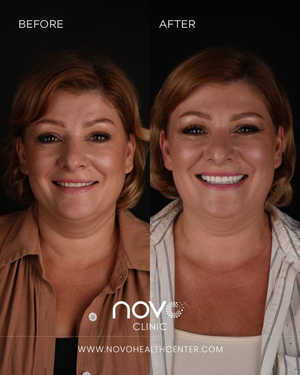 before and after photo