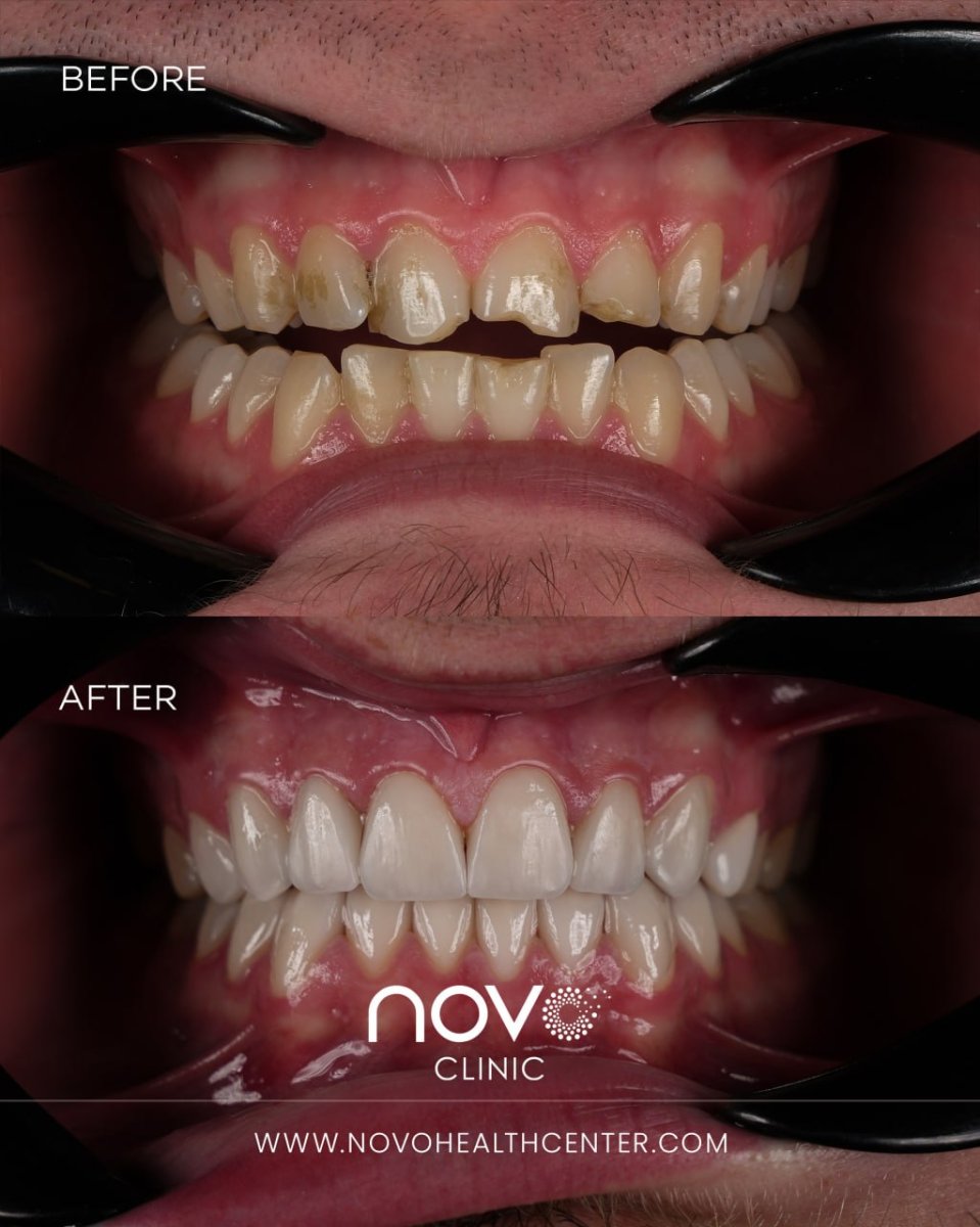 before and after photo