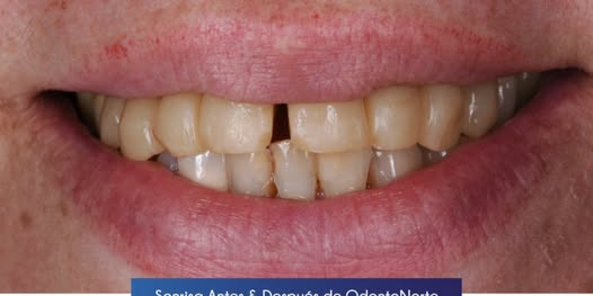 before and after photo