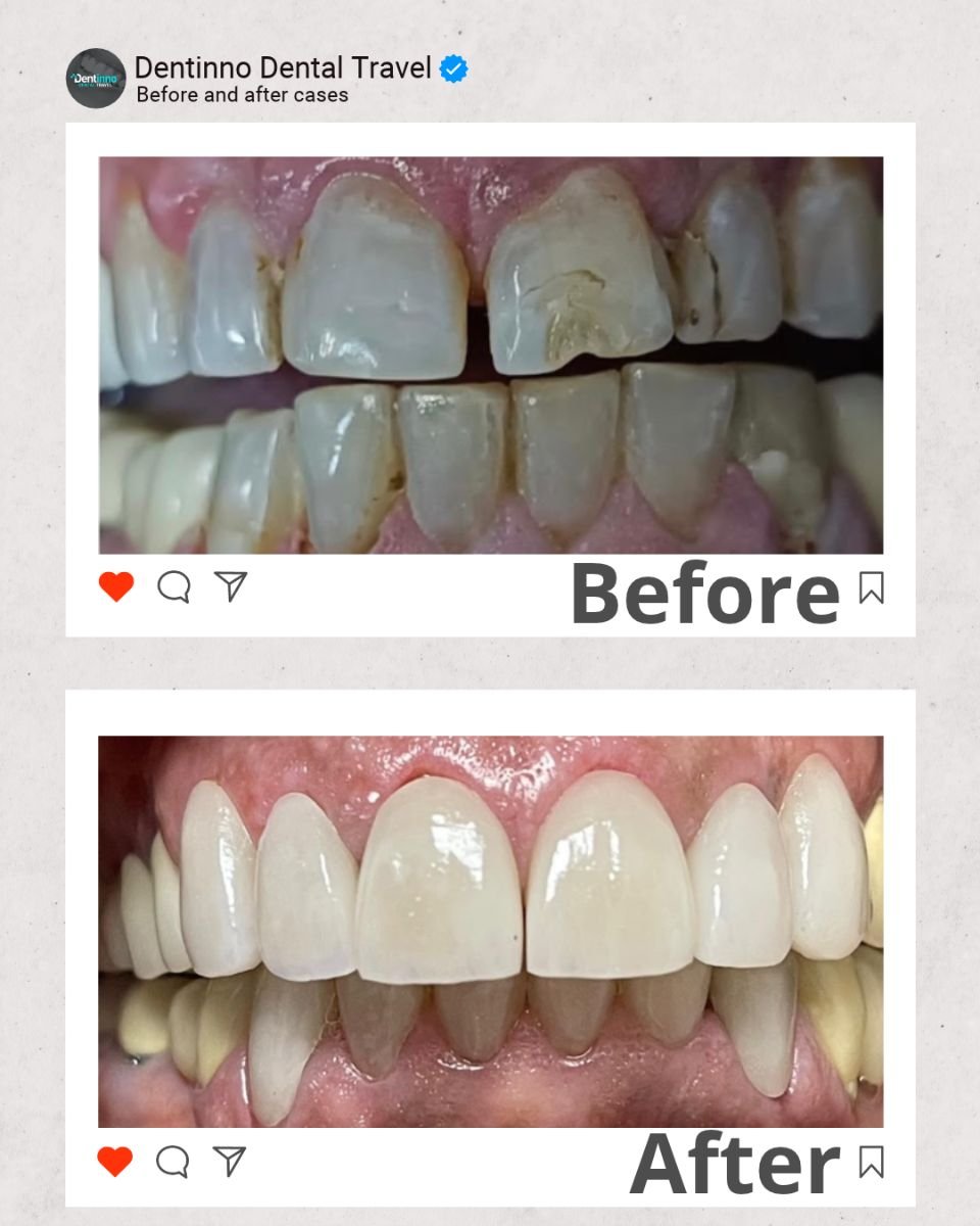 before and after photo