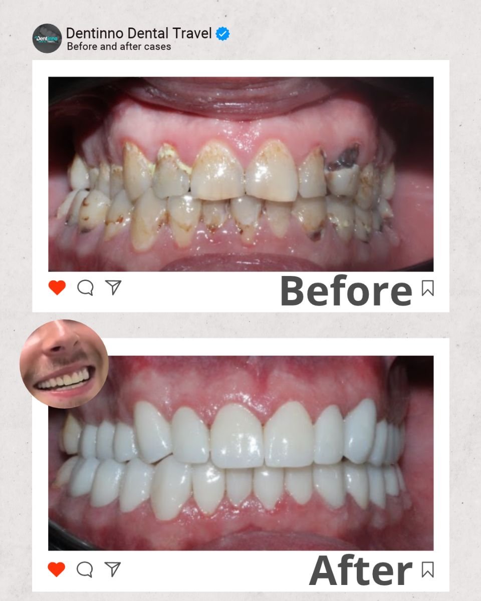before and after photo