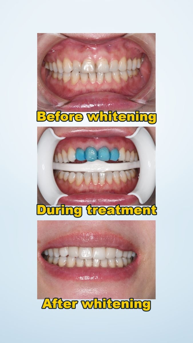 before and after photo