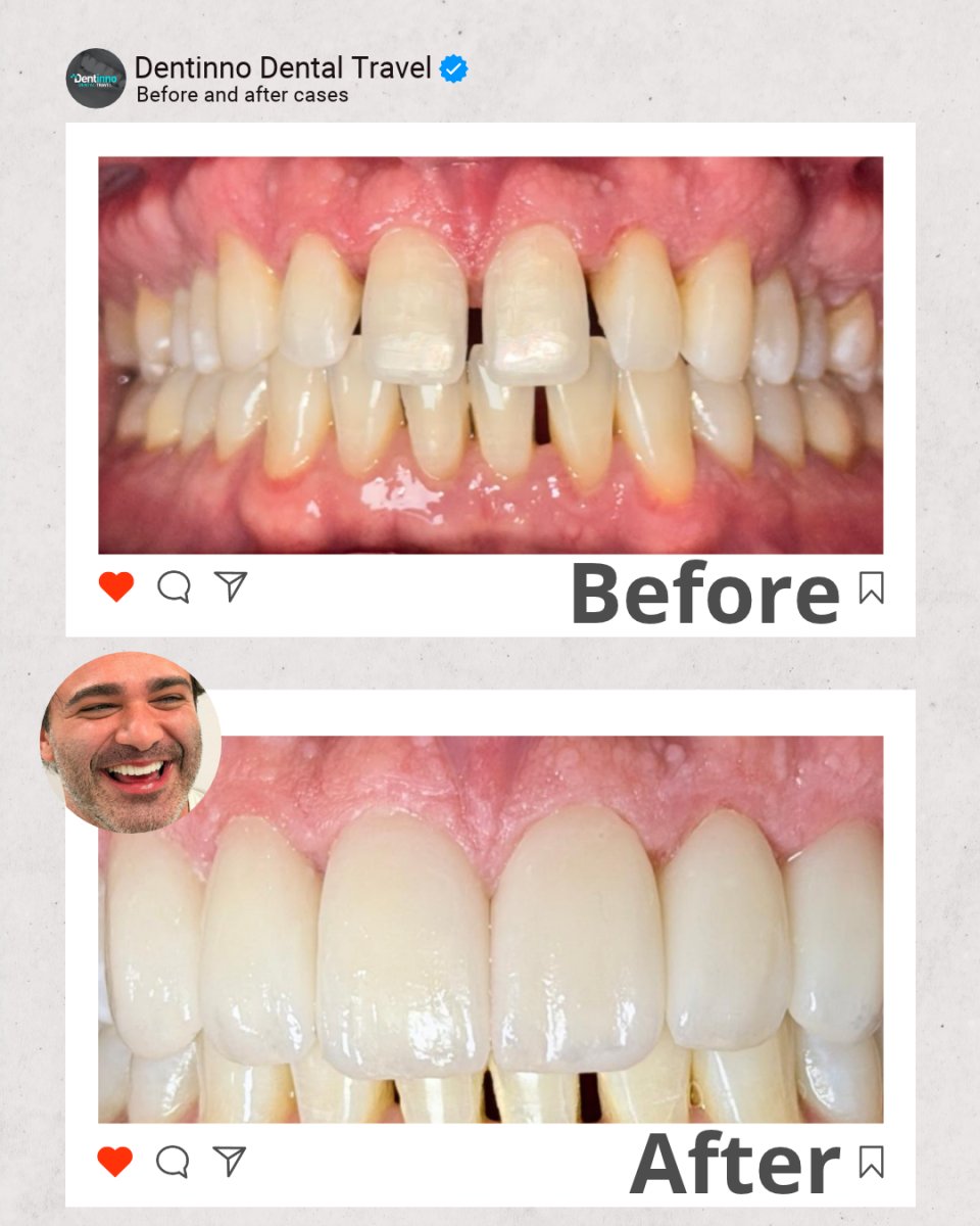 before and after photo