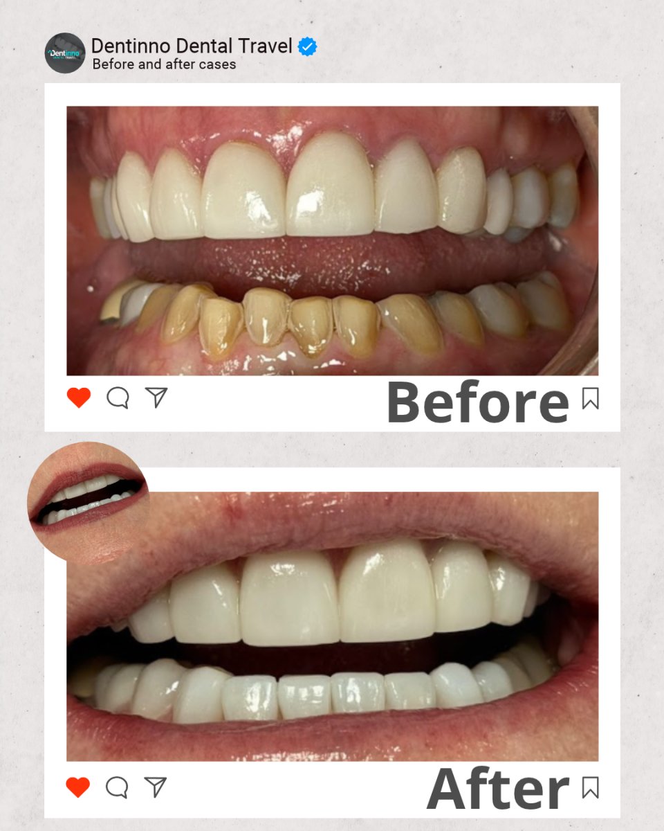 before and after photo