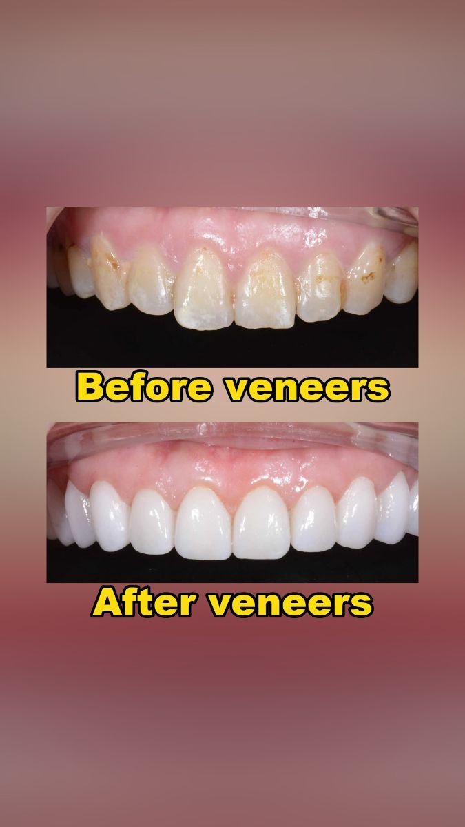 before and after photo