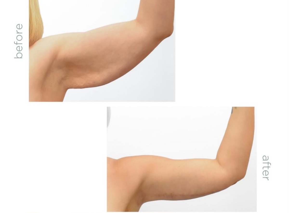 before and after photo