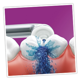 Reinigen der Zahnzwischenräume mit der Philips Sonicare AirFloss Ultra Reinigen der Zahnzwischenräume mit der Philips Sonicare AirFloss Ultra