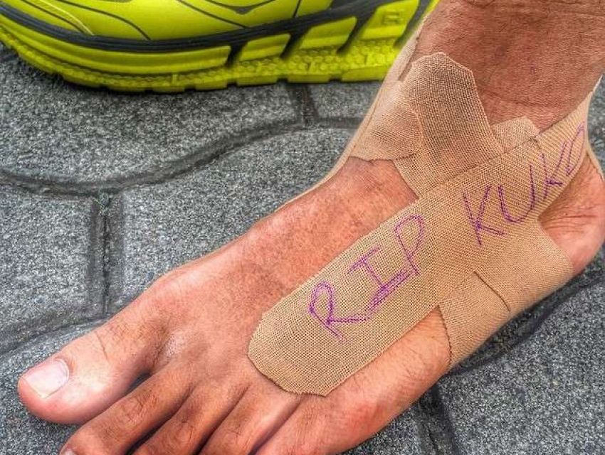 Siyah Ayak Tırnakları