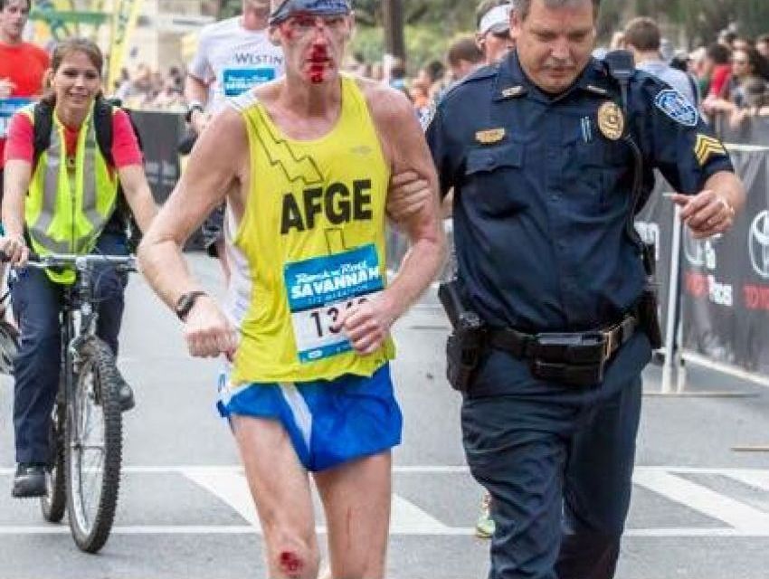 Önce Finish Sonra Dikiş!