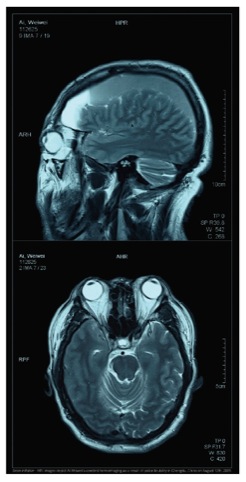 Ai Weiwei's skull