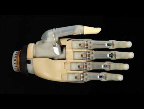 Touch Bionics iLimb 