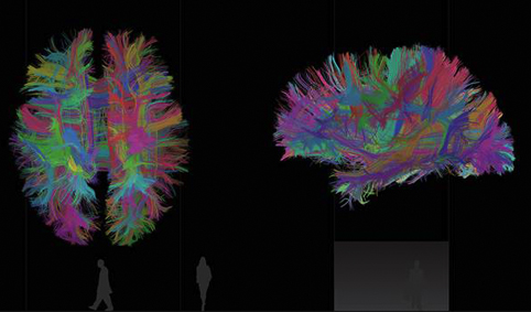 Visualisation of neurological data