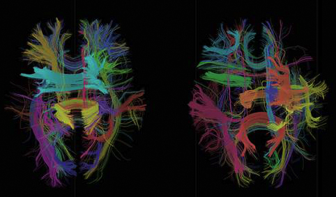 Visualisation of neurological data