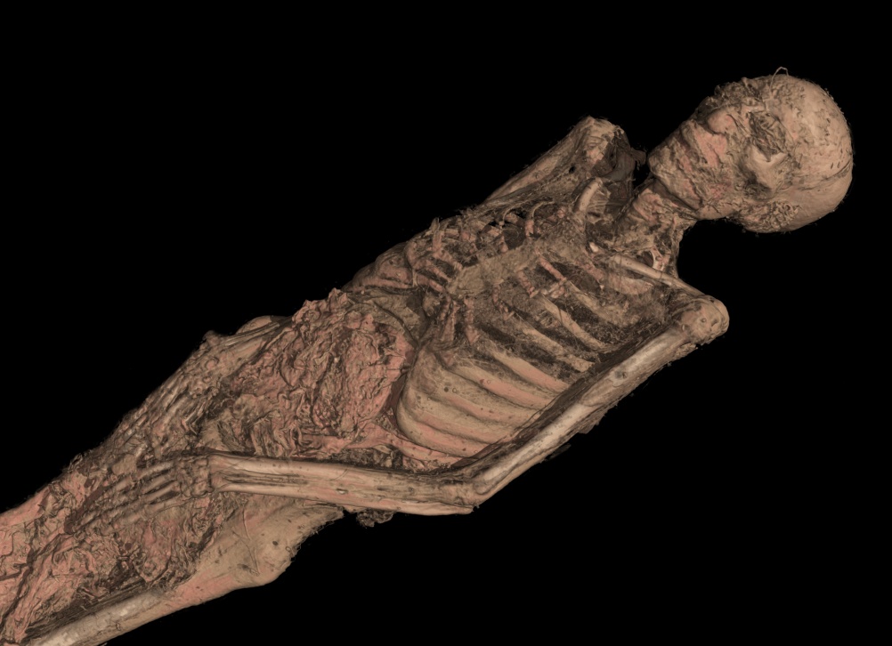 The CT scan of the mummy of an adult male (name unknown), showing his mummified remains. 