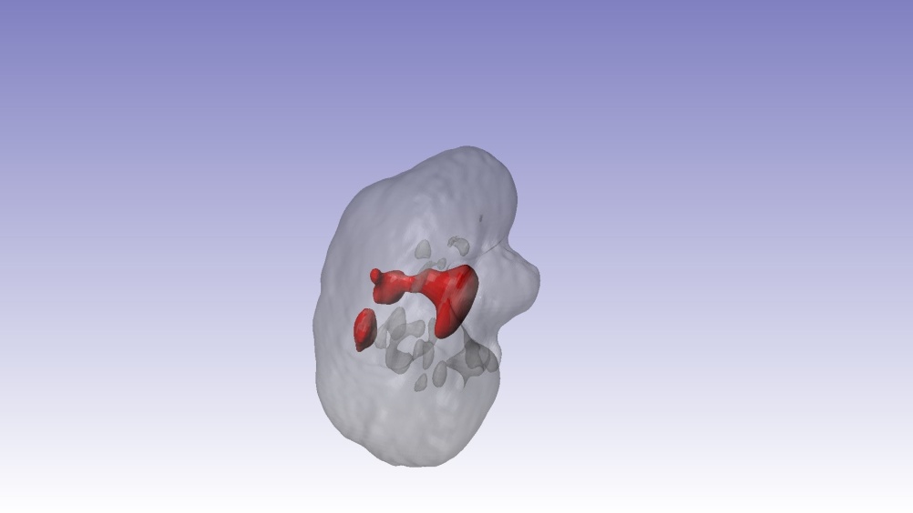 3D printed kidney project by Isodo3d