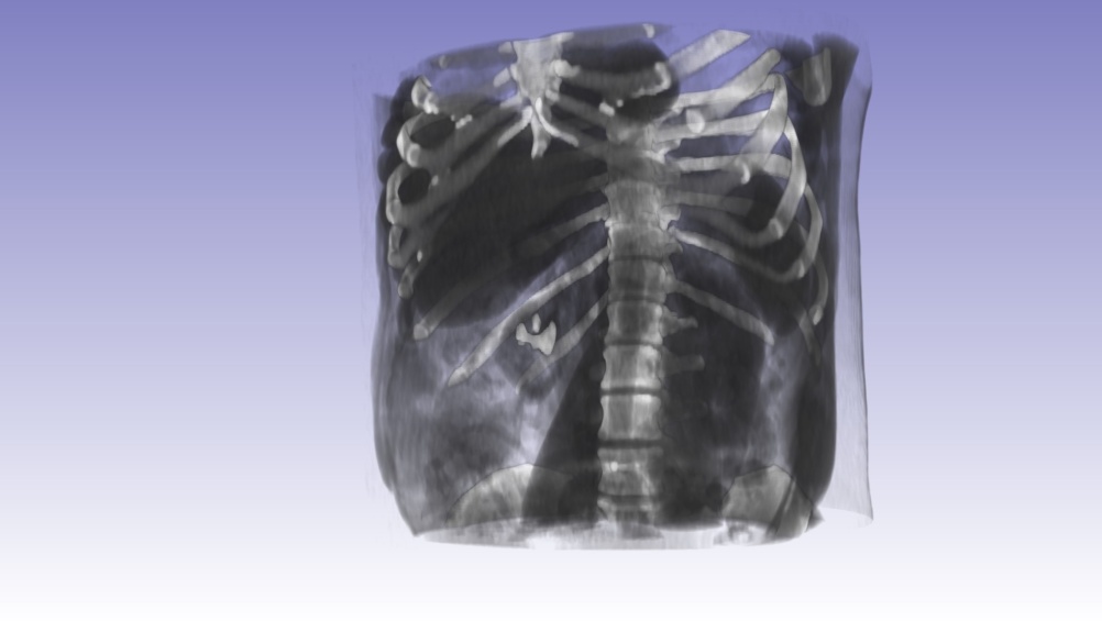 3D printed kidney project by Isodo3d