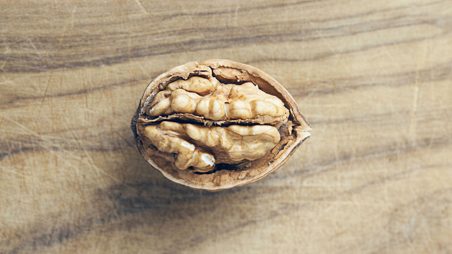 MRT Untersuchung bei MS