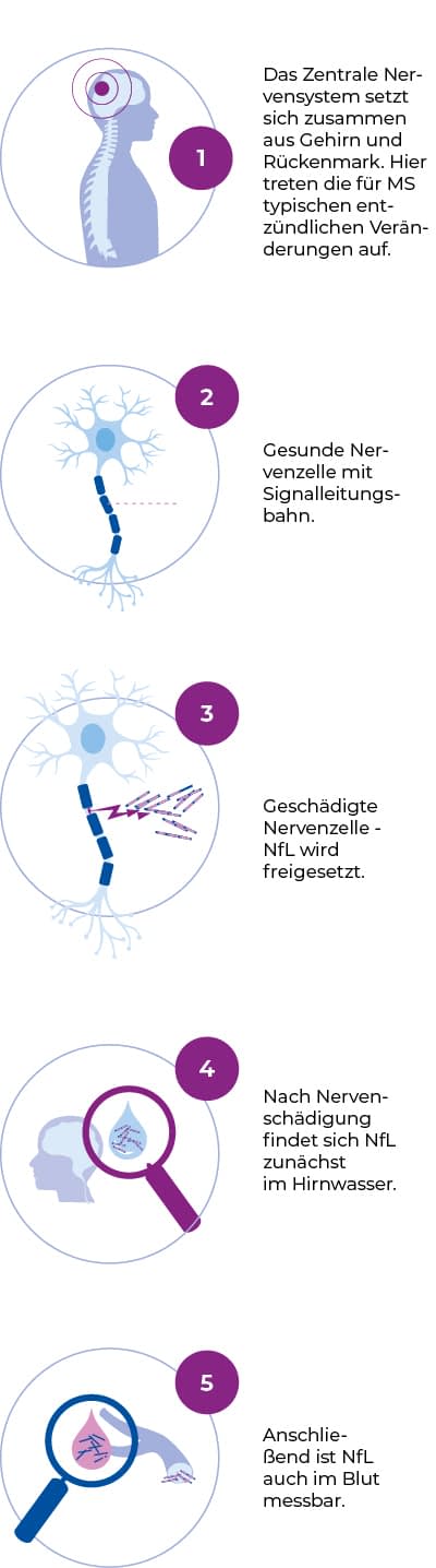 NfL im Blut NfL im Blut