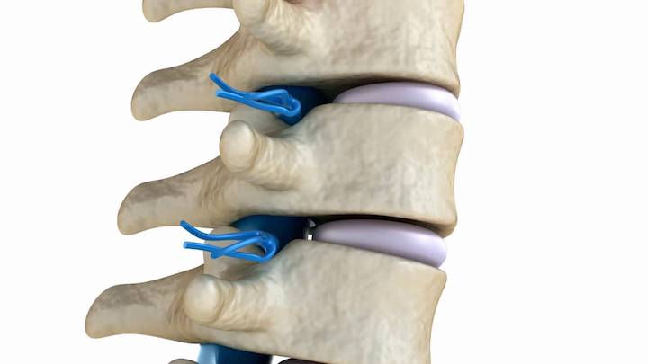 Dlaczego kręgosłup choruje?