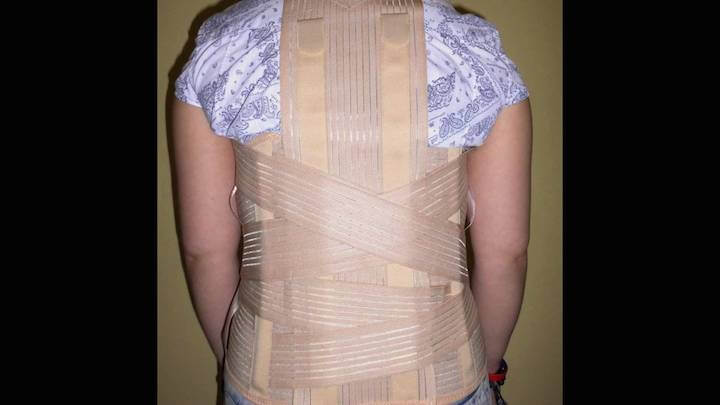 Wskazania do zastosowania gorsetów i jak tego uniknąć?