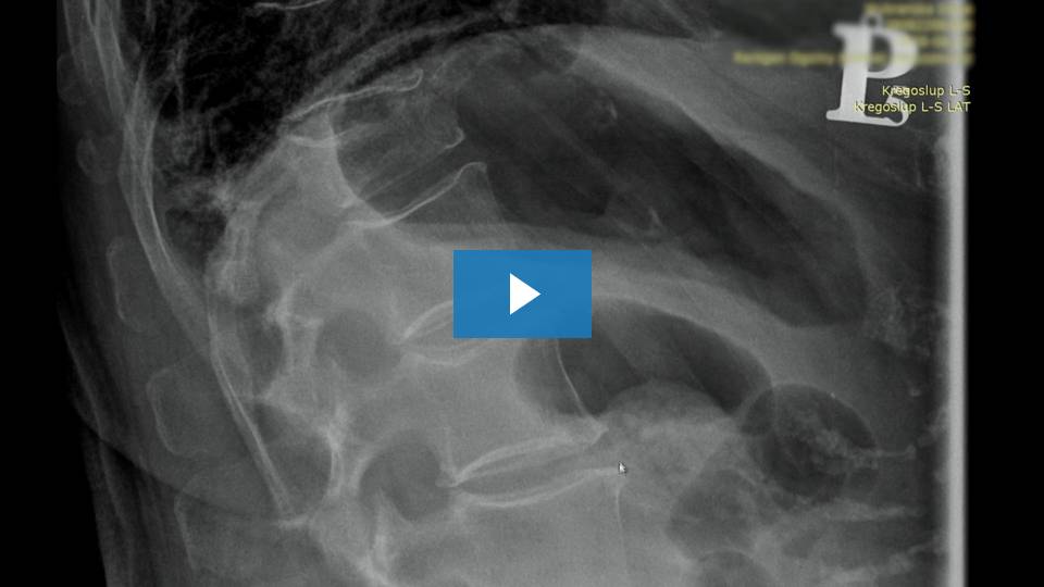 80-letnia Pani na pogotowiu po upadku