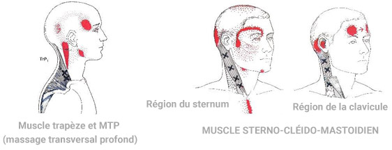 Náuseas cervical